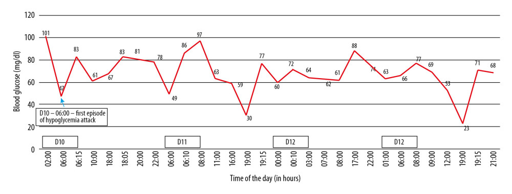 The patient’s glycemic profile on days 10–13. The first hypoglycemic attack happened on day 10. The patient had 3 more hypoglycemic attacks on the same day, day 11 and day 13. The blood glucose levels remained persistently either below of just above the normal range.
