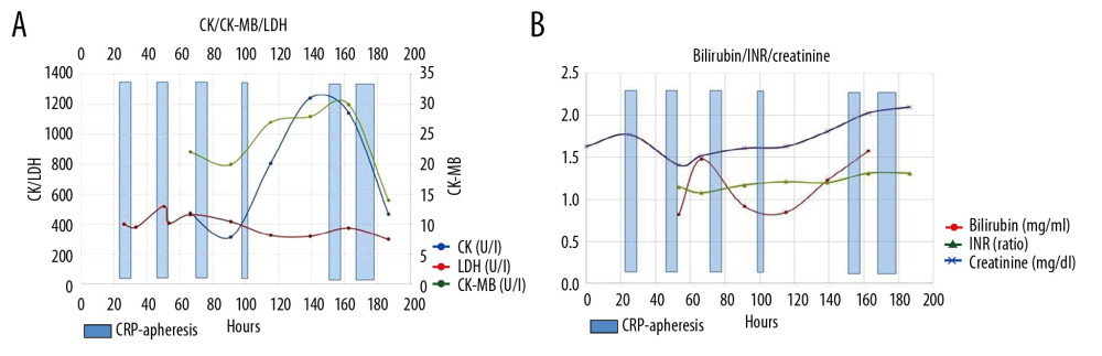 (A) CRP apheresis sessions (blue columns) and course of CK/CK-MB and LDH plasma levels. Interpretation see text. (B) CRP apheresis sessions (blue columns) and course of bilirubin and creatinine levels as well as international normalized ratio (INR). Marked CK/CK-MB increase occurred during the interruption of CRP apheresis and marked CK/CK-MB decrease occurred following CRP apheresis restart.