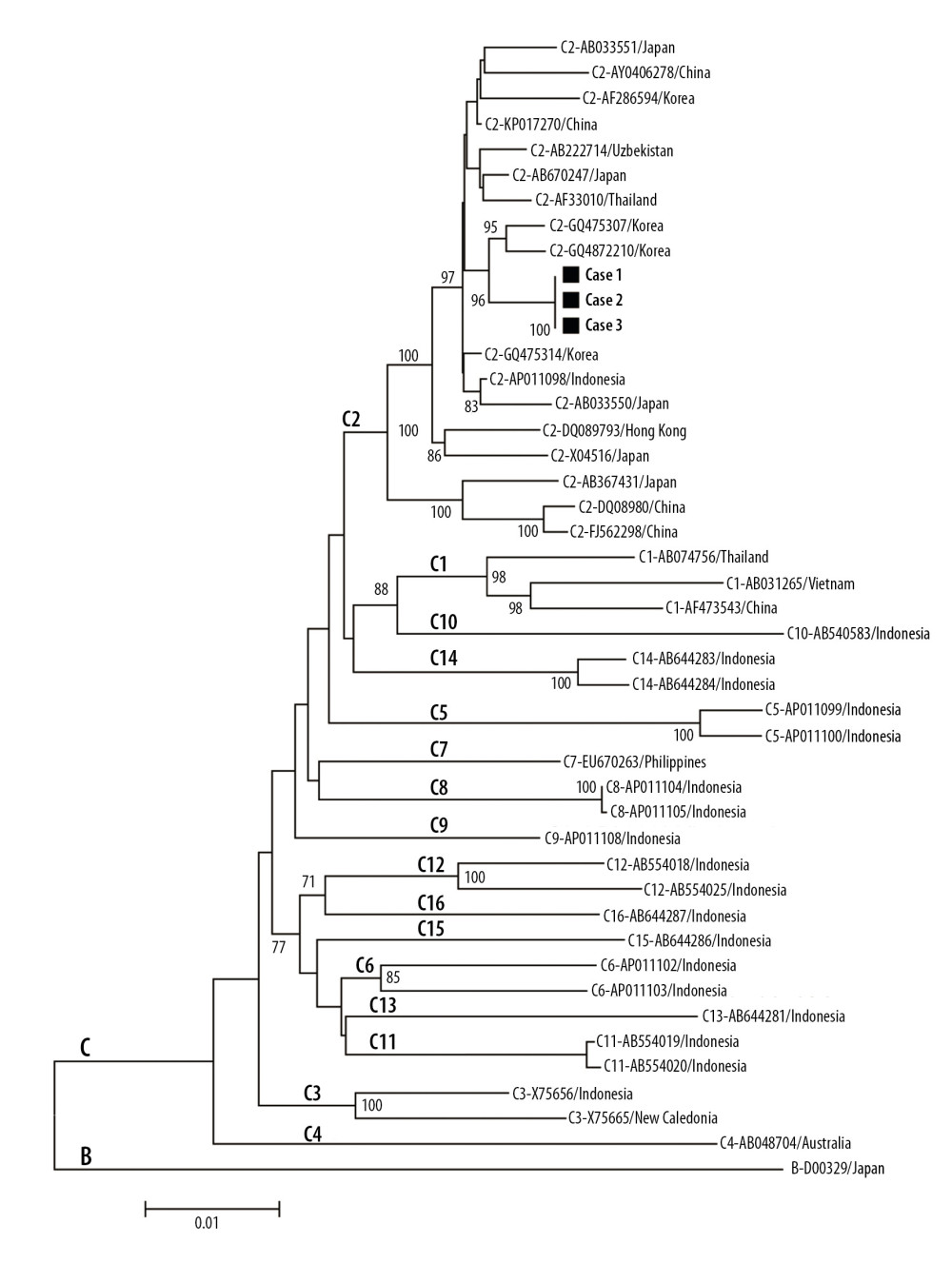 Phylogenetic tree of hepatitis B virus DNA. Sequencing of HBV revealed that all three patients were infected with identical subgenotype C2 HBV sequences.