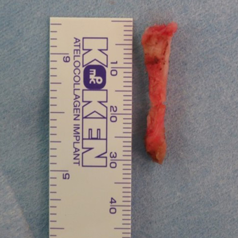 Specimen. The extracted bone tissue was 30 mm in length, and its tip had a nodular shape.