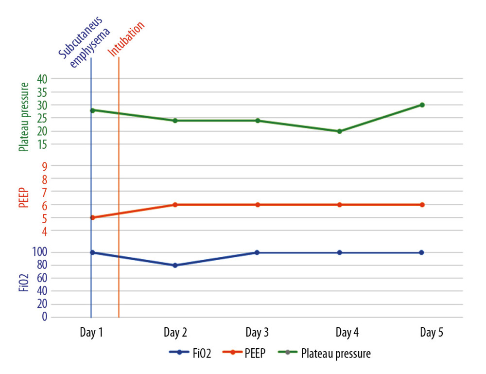 A graph showing the timeline of events and ventilator parameters for the first patient.