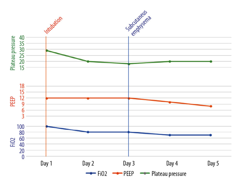 A graph showing the timeline of events and ventilator parameters for the second patient.