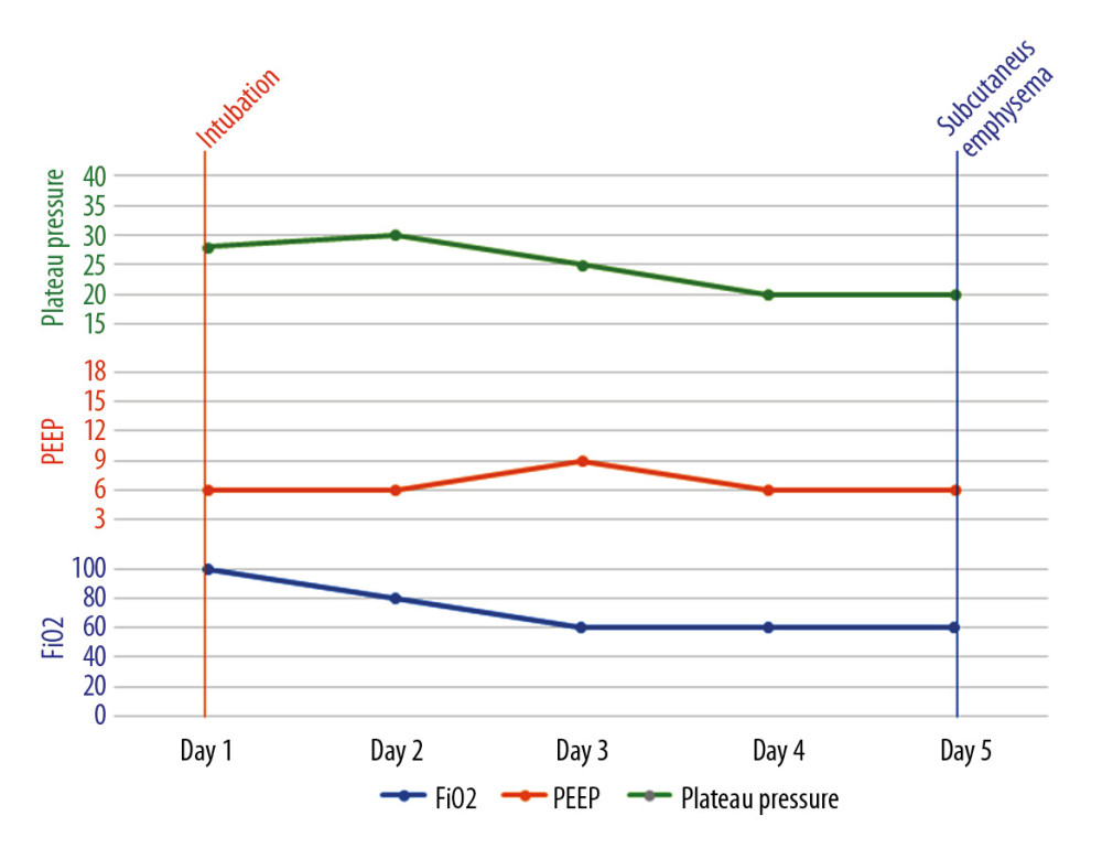 A graph showing the timeline of events and ventilator parameters for the third patient.