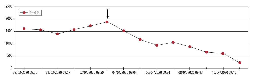 Ferritin levels dropped from >2000 ng/mL to 246 ng/mL after start of ozone therapy.