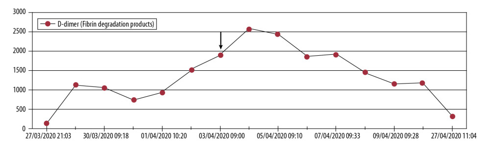 D-dimer levels dropped from 1900 ng/mL to 323 ng/mL after start of ozone therapy.