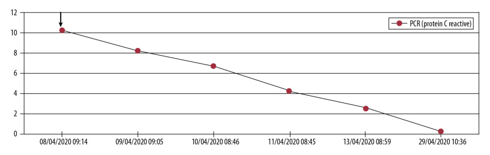 C-reactive protein levels dropped immediately after start of ozone therapy.