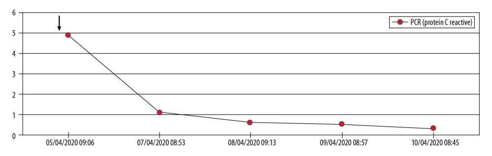 C-reactive protein levels dropped immediately after start of ozone therapy.