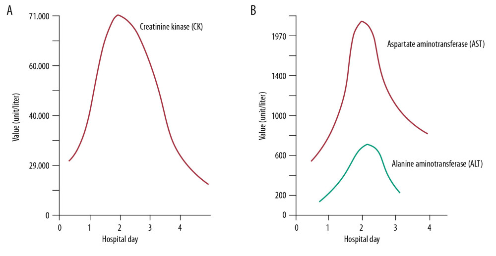 The patient’s serum creatine kinase and liver enzymes level over the course of her hospitalization. (A: Creatine kinase (CK). B: Aspartate aminotransferase (AST) and alanine aminotransferase (ALT). (A) Serum creatine kinase level increased from 29 000 U/L on Day 1 to 71 000 U/L while the patient was on maintenance fluids. In the following days, small boluses of normal saline were administered in addition to the maintenance fluid, and the serum creatine kinase started to decrease. (B) Liver enzyme levels started to increase the first day and then decreased after small boluses of normal saline were added. The levels follow the same pattern as those for creatine kinase. Also notice that the AST level is four times the ALT level during the hospital course.
