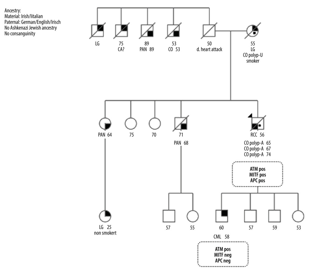 Pedigree of a family with the APC p. S2627Gfs variant. The pedigree depicts the affected individuals with cancer, cancer types, and genes with pathogenic variants. Circles and squares denote the female and male family members, respectively. Filled quadrants denote the affected conditions, and the arrow indicates the proband. CA? – possible cancer; CML – chronic myeloid leukemia; CO polyp-A – colorectal polyp adenoma; CO polyp-U – colorectal polyp type unknown; LG – lung cancer; PAN – pancreatic cancer; RCC – renal cell carcinoma.