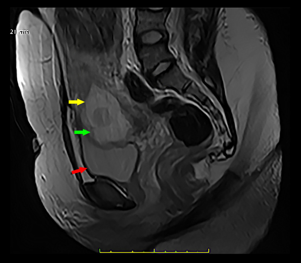 American Journal of Case Reports | Use of Magnetic Resonance 