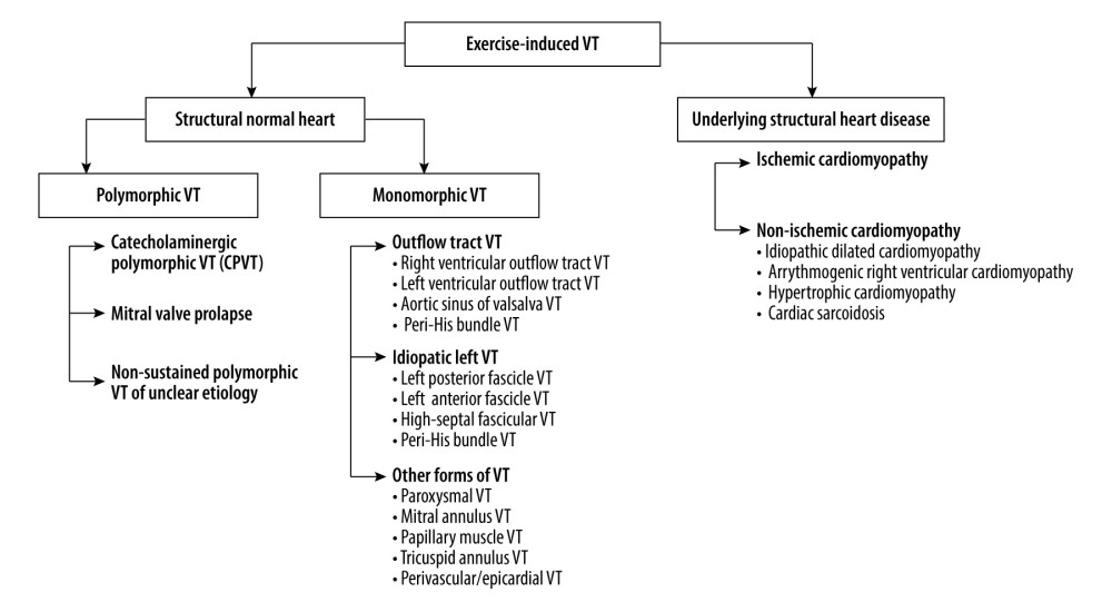 Classification of exercise-induced ventricular tachycardia. Adapted from Tang et al. [10] and Michowitz et al. [14].
