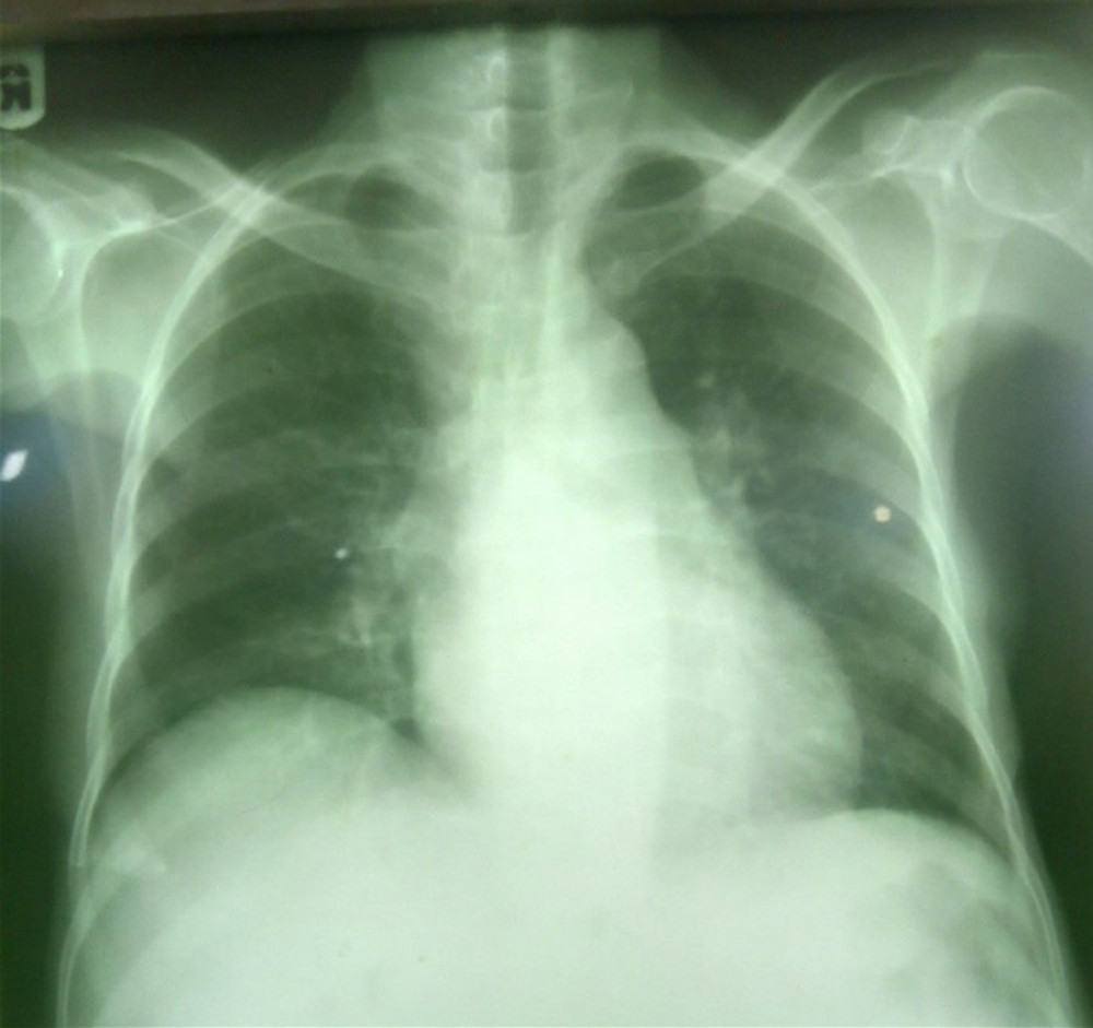 Chest X-ray of the patient.