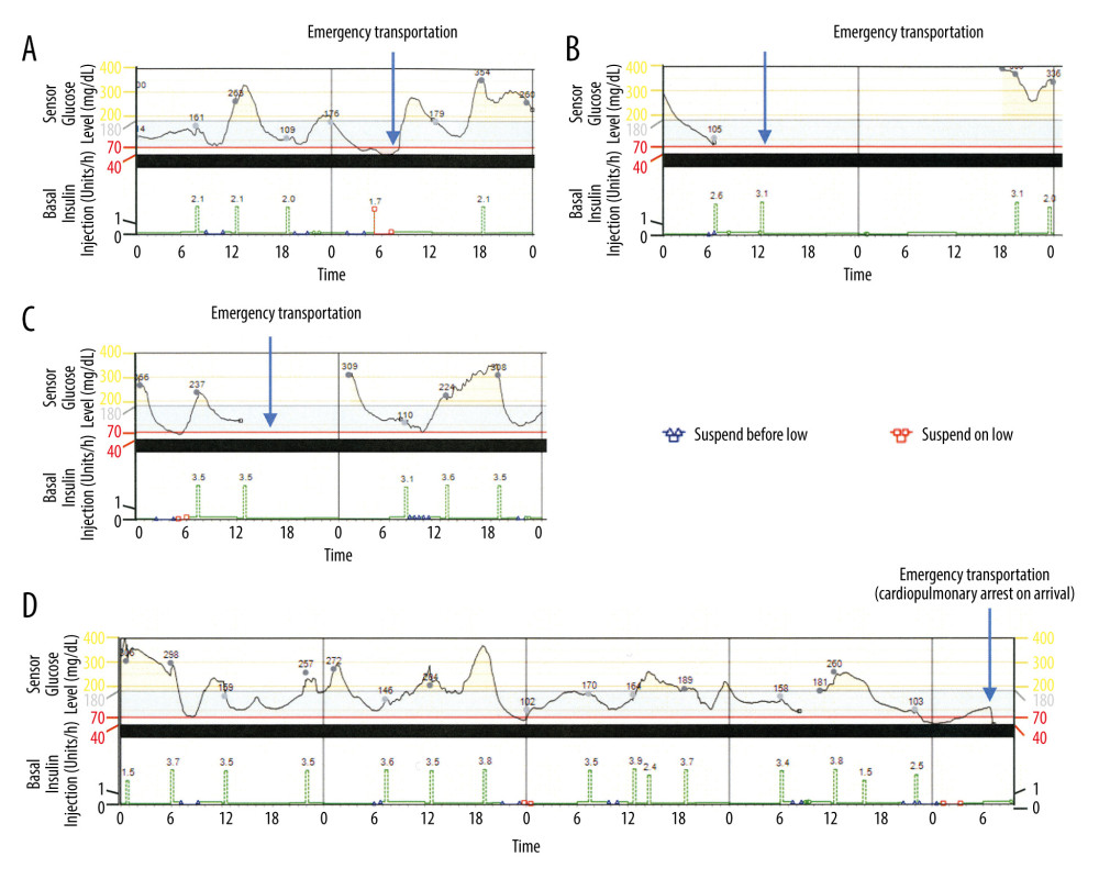 The CGM of the patient. (A–C) CGM data on the day of patient referral to our Emergency Room due to hypoglycemia after starting SAP therapy with the PLGM function. The values on the graph of the sensor glucose levels show the blood glucose level measured by self-monitoring blood glucose. The values on the graph of basal insulin infusion show the units of insulin used for bolus infusion. (D) CGM data during the last 5 days before the sudden death of the patient.