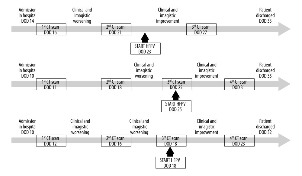 Timeline of patients from hospital admission to discharge. (A) Case 1; (B) Case 2; (C) Case 3. HFPV – high-frequency percussive ventilation; DOD – days from disease onset.