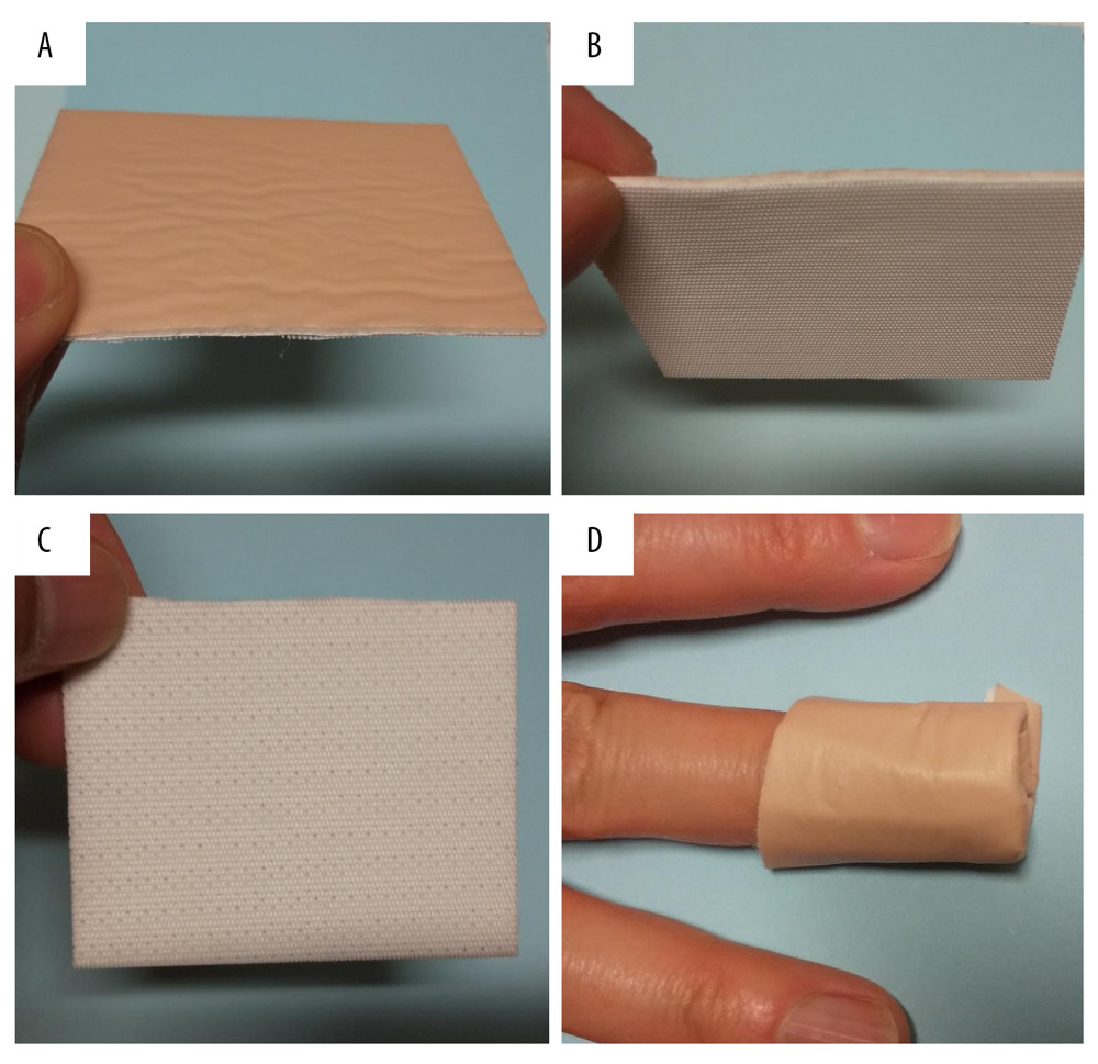 The moist wound dressing (Plus moist™) used in this case Plus moist™ consists of 3 layers. The outer leak-proof layer that prevents the exudate from leaking (A), the middle absorbent layer that absorbs the exudate (B), and the inner permeable layer that comes in contact with the wound (C). Plus moist™ after application (D).