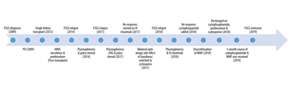 Timeline of FSGS disease, relapses, and medication regimen. FSGS: focal segmental glomerulosclerosis. PD – peritoneal dialysis; MMF – mycophenolic acid; IVIG – intravenous immunoglobulin.