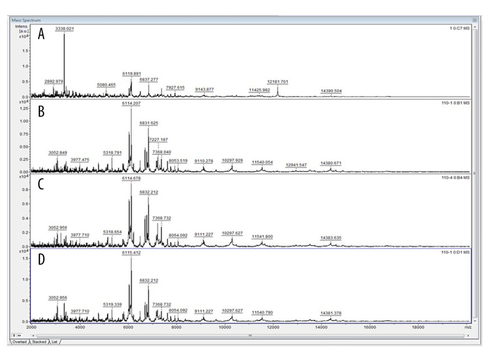 Mass spectral analysis findings. The findings for Microsporum canis ATCC standard strain (A) are different, but matched peaks are seen in the M. canis species isolated from the father (B), mother (C), and sister (D).