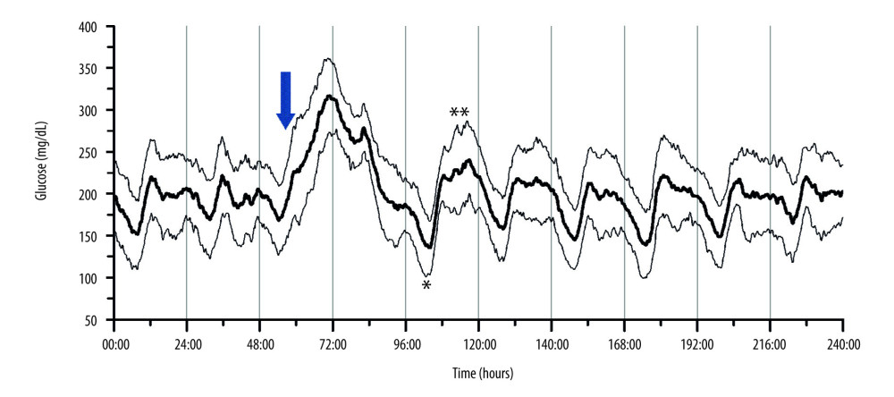 The 10 days CGM glycemia profile of 23 cycles following chemotherapy which contained one dose of IV Dexamethasone (arrow). It demonstrated a triphasic glycemic pattern gradually returns to baseline after 3 days. (Lighter lines are standard deviation) (* Normal glucose phase between 2 hyperglycemia phases; ** hyperglycemia plateau shape similar to the baseline.)