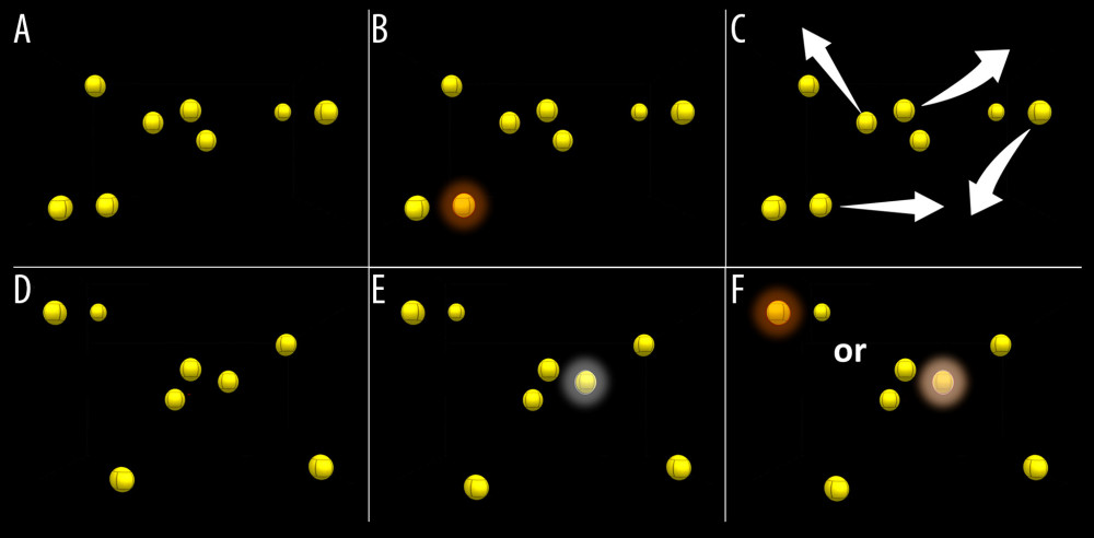 Principle of audiovisual stimulation (NeurofyResearch) program. Sequence of the visual task. (A) Eight yellow still spheres are present in a virtual cube. (B) One of these spheres turns red for 15 s (cued target) and returns yellow. (C) All spheres randomly move following linear paths across the visual field encompassing the blind field and bouncing on one another and on the walls of the virtual 3D cube when collisions occurred. (D) After 30 s, spheres stopped moving. (E) The patient had to select the cued target using a hand-guided laser pointer. (F) Correct selection was considered a positive hit.