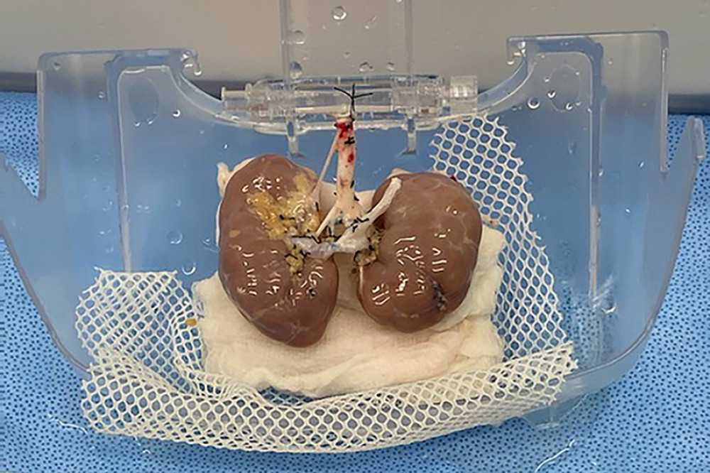 The 2-month-old en bloc kidneys before placement in the renal preservation machine.