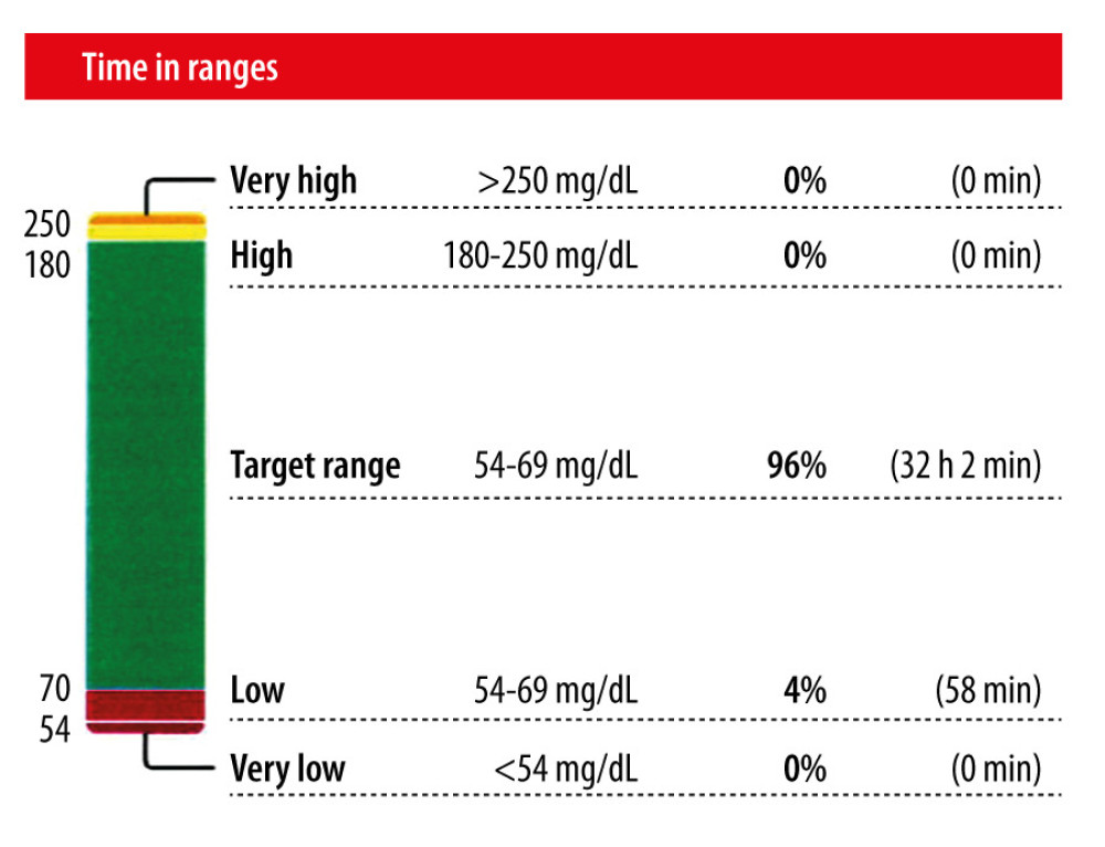 Composition of glucose readings during continuous glucose monitoring.