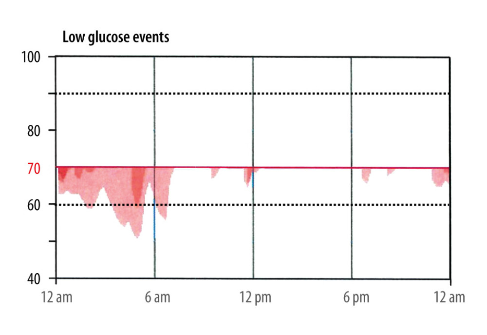 Frequency and timing of hypoglycemic events throughout a 24-hour period.