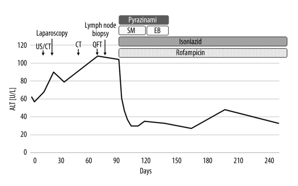 Clinical course. The diagnosis of disseminated tuberculosis (TB) was established. Thereafter, 4 anti-TB drugs were administered immediately. Twenty days after the start of the administration, the serum alanine aminotransferase (ALT) levels decreased to normal. After 1 month, streptomycin (SM) was replaced with ethambutol because of concerns about an auditory disorder. After 2 months of the 4-drug antituberculotic therapy, pyrazinamide and ethambutol (EB) were discontinued, but treatment with isoniazid and rifampin was continued. Approximately 6 months after the initiation of therapy, the patient’s liver function test results showed improvement. QFT – QuantiFERON test (interferon-γ releasing assay); US – ultrasonography; CT – computed tomography.