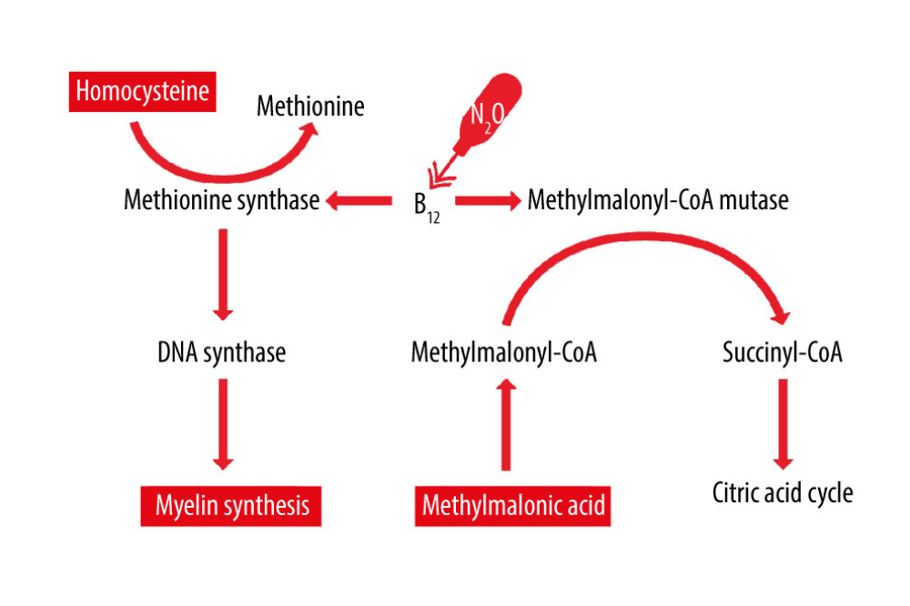 Schematic overview of the effect of vitamin B12 on the metabolism of methylmalonic acid and homocysteine. Nitrous oxide (N2O) oxygenates the core of vitamin B12 (B12), leading to inactivation and functional vitamin B12 deficiency. This results in elevated levels of methylmalonic acid and homocysteine.