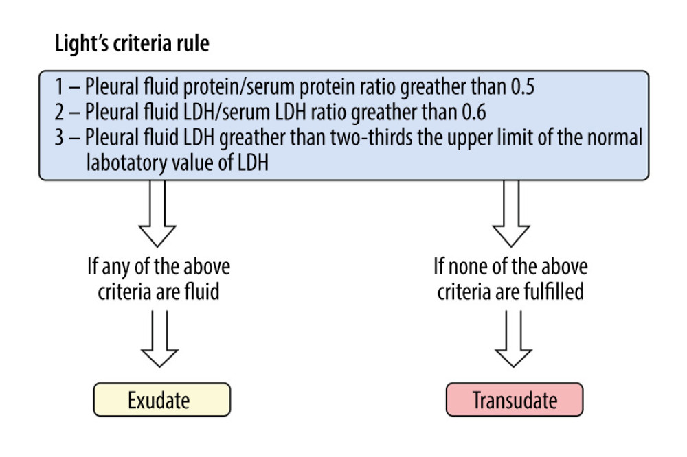 The definition and the main features of Light’s criteria adopted to diagnose pleural effusion into exudate and transudate based on the pleural fluid chemical profile. LDH – lactate dehydrogenase.
