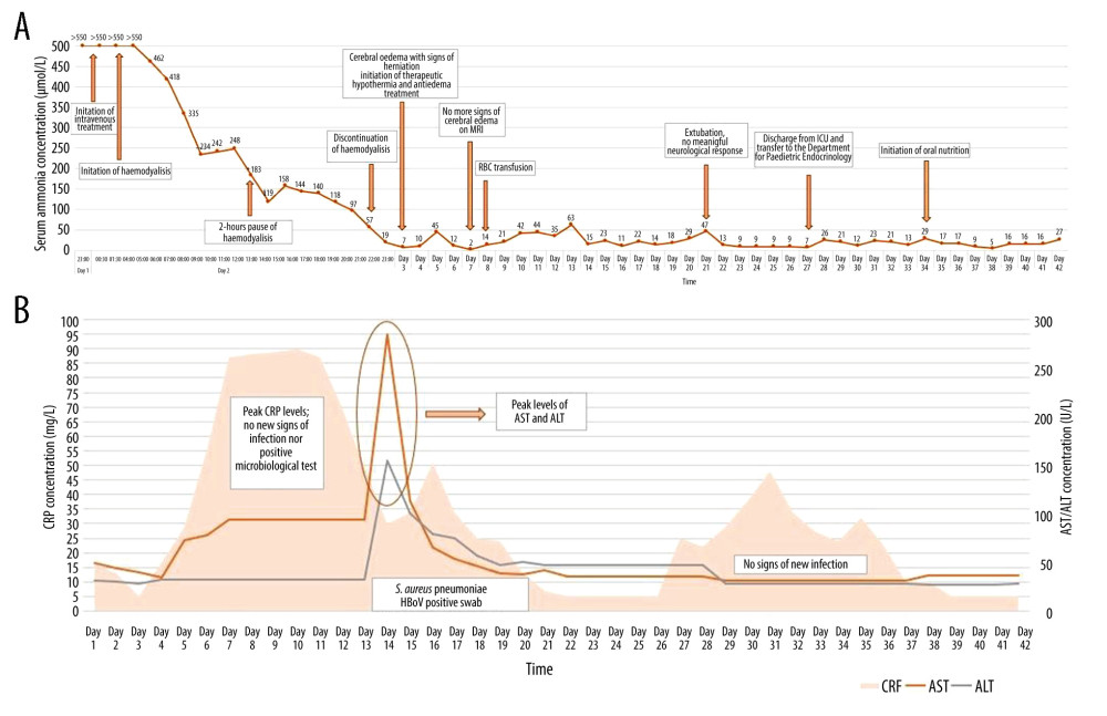 (A) Ammonia concentration and important turning points in clinical state and treatment over time of hospitalization. (B) Aspartate transaminase (AST), alanine transaminase (ALT), and C-reactive protein concentrations over time of hospitalization.