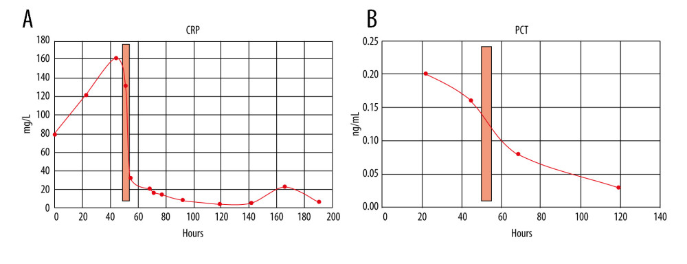 (A) CRP levels (reference range 0.00–5.00 mg/L) during the course of the patient’s hospital stay. CRP levels were elevated on admission (79.2 mg/L) and sharply increased on day 2 (maximum 161.63 mg/L). Due to CRP apheresis (light red columns) via central venous access, CRP levels markedly dropped and further declined later on. A second low CRP peak (22.41 mg/L) on day 7 remained clinically inapparent. (B) PCT levels (reference range <0.5 ng/mL) remained normal during the hospital stay.