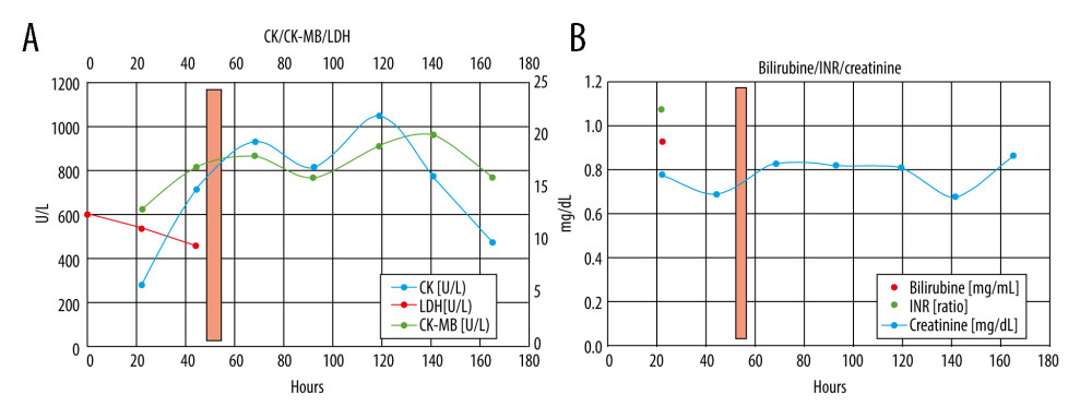 (A) CRP apheresis (light red column) and course of CK/CK-MB and LDH plasma levels. Only CK slightly increased, likely due to positioning of the patient (muscular CK). In contrast, CK-MB levels remained normal. (B) CRP apheresis (light red column), bilirubine, international normalized ratio (INR), and creatinine levels. Normal values for each parameter.