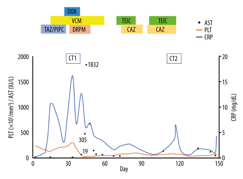 Summary of the clinical course from day 1 to day 150. DOA – dopamine; VCM – vancomycin; TEIC – teicoplanin; TAZ/PIPC – tazobactam piperacillin hydrate; DRPM – doripenem; CAZ – ceftazidime; CT – computed tomography; PLT – platelet; AST – aspartate aminotransferase; CRP – C-reactive protein.