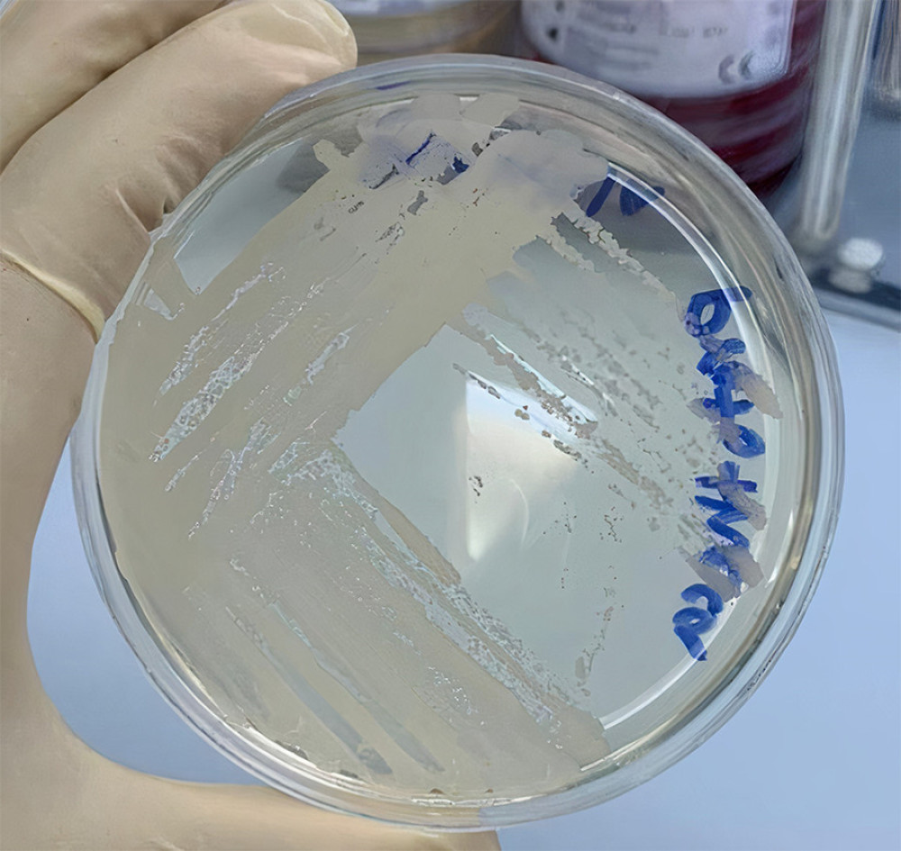 P. zopfii appearance after 24 hours on Sabouraud dextrose agar shows growth of smooth, moist, white to cream colony on SDA after 24 h incubation period on 37°C, image taken on 2 May 2021.