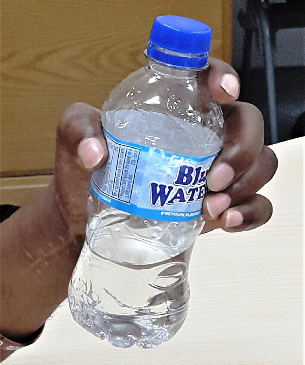 Photo of the replanted left hand showing the patient’s ability to hold a water bottle.