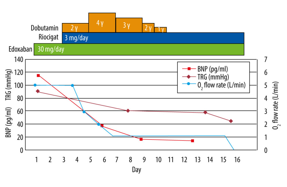 American Journal of Case Reports Pulmonary Tumor Thrombotic