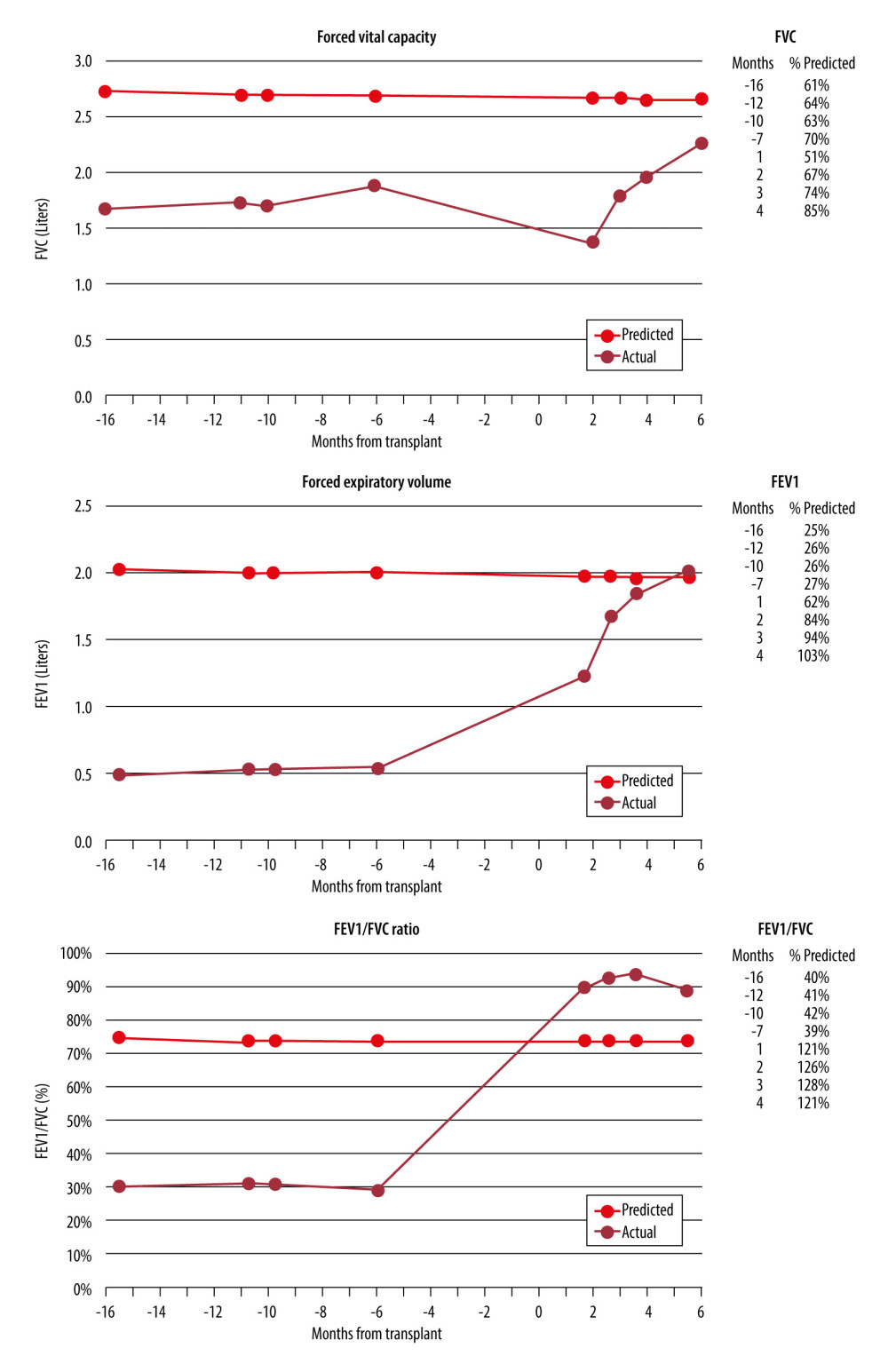Lung function profile of recipient before and after transplantation showing improved function following transplantation.