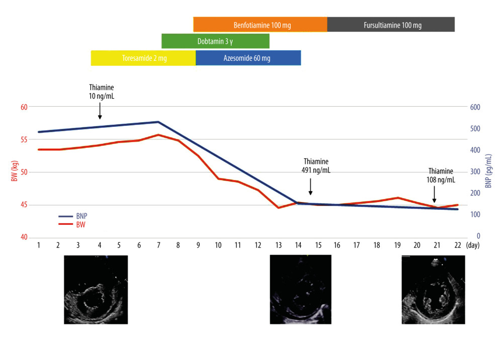 The time course of the changes in body weight (kg) and brain natriuretic peptide (pg/mL), and an echocardiogram in the parasternal short-axis view.