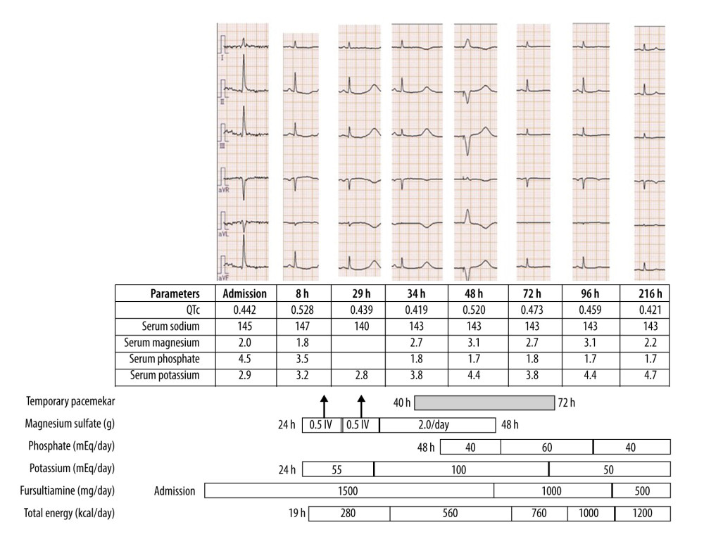 Summary of parameters and the 12-lead electrocardiographs during the patient’s clinical course. IV – intravenous.