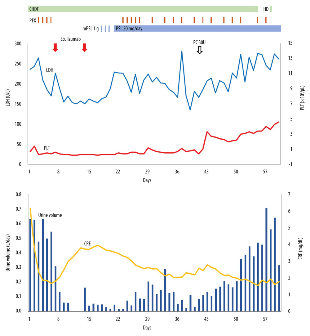 Clinical course and the values of thrombotic microangiopathy. On admission, the patient showed a low platelet count (red line), increased levels of creatinine (yellow line), mildly elevated lactate dehydrogenase (blue line), and reduced urine volume (blue column). We introduced continuous hemodiafiltration (CHDF) on day 1. Plasma exchange (brown bars) was initiated at day 3, for 24 times. Because the platelet count, creatinine levels, and urine volume did not change in response to plasma exchange, we administered 900 mg of eculizumab on days 7 and 14 (red arrow). After the initiation of eculizumab, the platelet count, creatinine levels, and urine volume did not recover. We administered 1 g of mPSL for 3 days on day 18, followed by 20 mg of PSL per day. We transfused 30 units of platelet concentrate on day 42. On day 43, the patient was diagnosed with thrombotic microangiopathy secondary to systemic sclerosis. We performed repeated plasma exchanges on day 64. CHDF was discontinued on day 55, and intermittent HD was performed from day 56. Subsequently, platelet count and creatinine levels were controlled. Because urine volume was also controlled, intermittent hemodialysis was terminated on day 151. CHDF – continuous hemodiafiltration; HD – hemodialysis; PEX – plasma exchange; mPSL – methylprednisolone; PSL – prednisolone; LDH – lactate dehydrogenase; PLT – platelet count; CRE – creatinine.