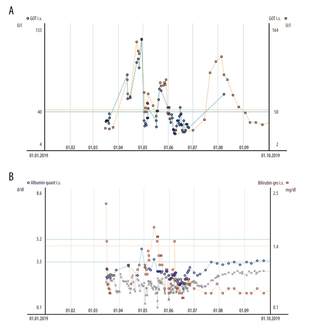 (A) Elevated and impaired liver enzymes alanine transaminase (red squares) and aspartate transaminase (blue circles) during the complicated course of infection and hemorrhage in a long-term complication after pancreas-kidney transplantation (GOT – glutamic oxaloacetic transaminase=aspartate transaminase; GPT – glutamate pyruvate transaminase=aspartate transaminase; i.s. – in serum). (B) Quantitative albumin (blue circles), total bilirubin (red squares), and hemoglobin (grey crosses) during the complicated course of infectious and hemorrhagic situation as a long-term complication after pancreas-kidney transplantation (i.s.: in serum).