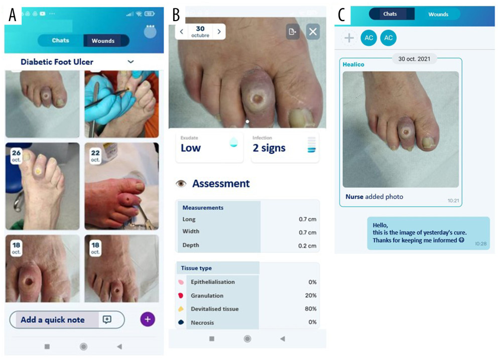 Healico© interface. (A) Dashboard of Healico© with images of different states of the same wound. By selecting 1 of the pictures, all the clinical data of the wound appears. (B) Dashboard with the clinical information of the wound: level of exudate, signs of infection, measures, and type of tissue, among other data. (C) Chat of the wound-care team. In this case, a nurse sent a picture of a patient’s ulcer after the cure to the podiatrist to inform her about the patient wound evolution.