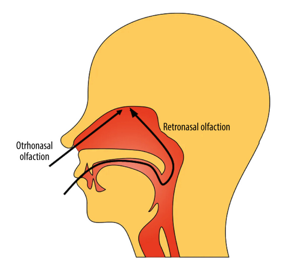 A diagram of orthonasal and retronasal olfaction. Orthonasal olfaction is airflow from anterior nares and retronasal olfaction is airflow from the choanae.