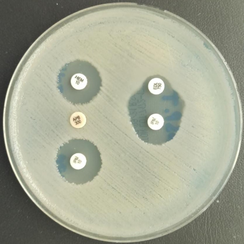 Induction method with EDTA and APB disk to presumptively detect resistance mechanisms, showing a reaction with the EDTA disk (NDM).