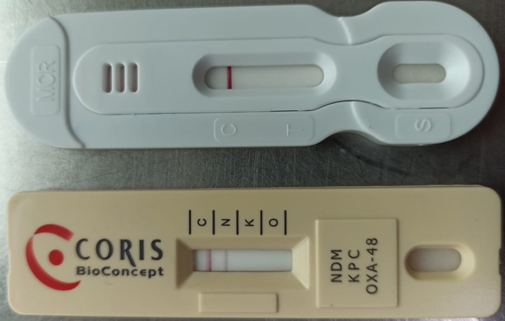 Rapid test for the detection of OXA-48, KPC, and NDM in bacterial isolates (RESISTET-3 O.K.N. K-Set/Coris BioConcept), showing a positive reaction for NDM.