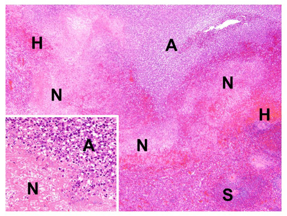 Histopathology of splenic abscesses. Hematoxylin and eosin. Original magnification ×20. Inset, original magnification ×200. A – abscesses as shown by accumulation of neutrophils; H – hemorrhage; N – necrosis; S – normal splenic tissue.
