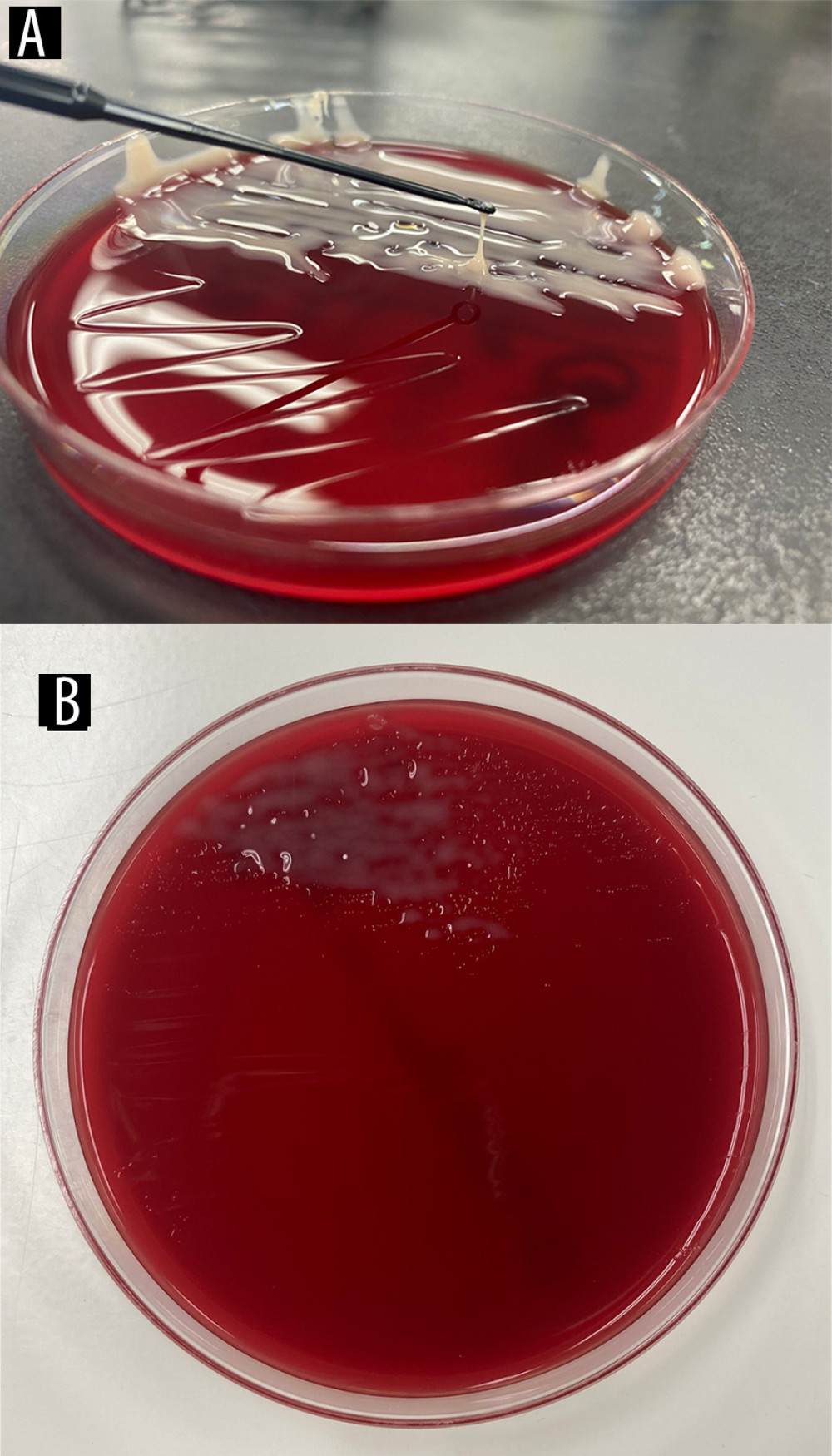 Mucoid-typeS. maltophilia colony. String-positive (A), S. maltophilia on blood agar (B).
