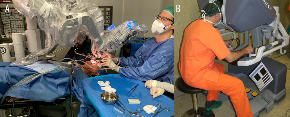 The Intuitive Da Vinci® Surgical System: patient-side cart with camera and instrument arms (A); surgeon’s console (B).