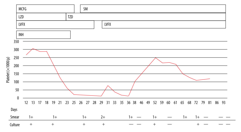 Clinical course of the patient. The line graph shows the platelet counts of the patient. Smear and culture of M. tuberculosis from sputum are expressed as 2+, 1+, +, and –.