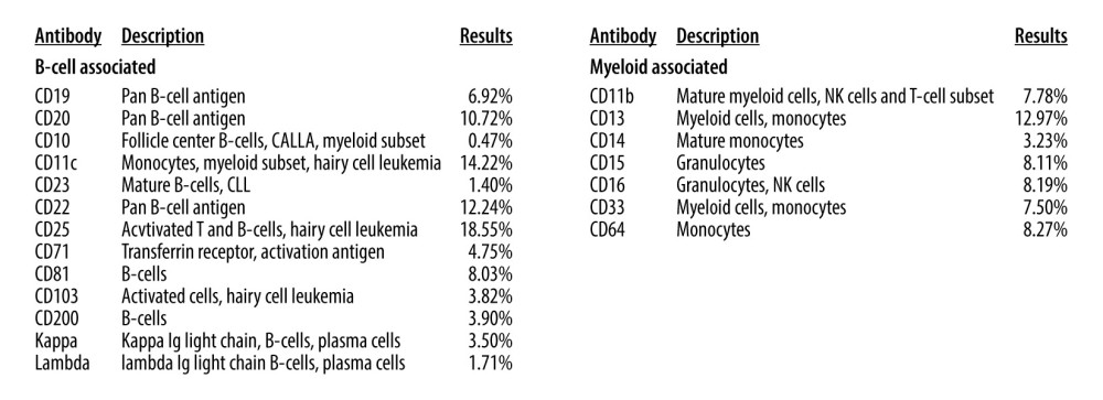 Flow cytometry. Trace B cell population exhibiting bright CD20, K LC excess, and increased forward scatter angle (<1% cellularity). Monocytes are relatively increased (~13% with a subset showing abnormal loss of CD14). No evidence for an acute leukemia or T cell lymphoproliferative disorder.